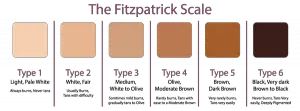 La grille de couleur de peau de Fitzpatrick ou la Fitzpatrick Skin Type (FST)